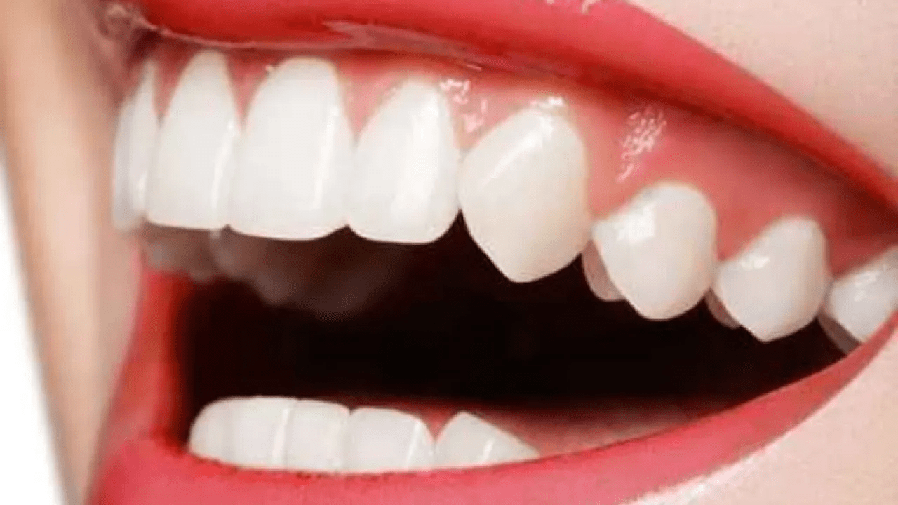 dicas para ter dentes sempre saudáveis